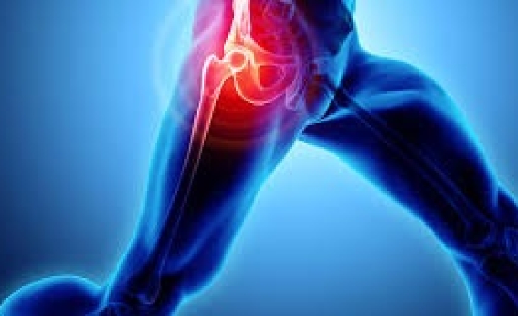 Παραισθητική μηραλγία